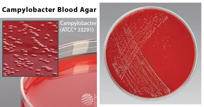 Campylobacter Blood Agar