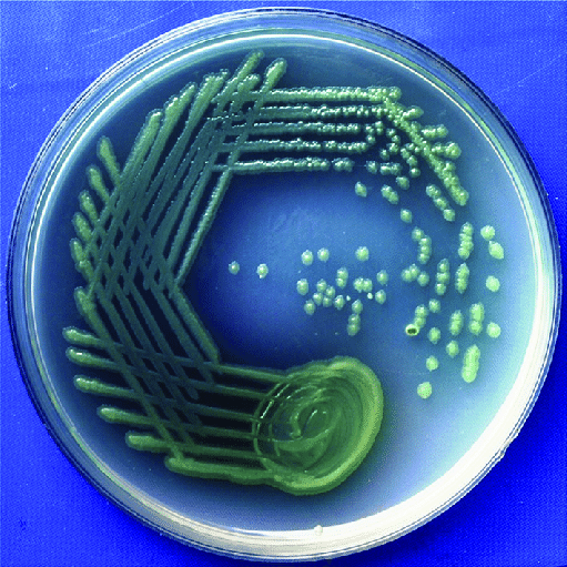 Pseudomonas aeruginosa on nutrient agar.