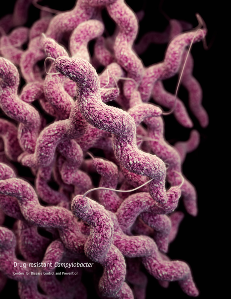 Campylobacteriosis