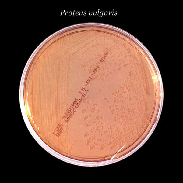 MacConkey agar