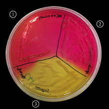 Mannitol salt agar