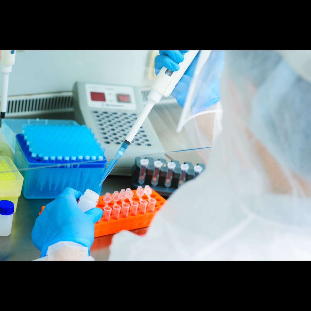 Tick borne Encephalitis Virus ''TBEV'' Real Time RT PCR Assay   50 Reactions